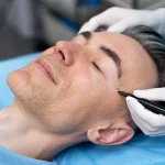 5 Factors Men Should Consider Before Getting Eyebrow Embroidery